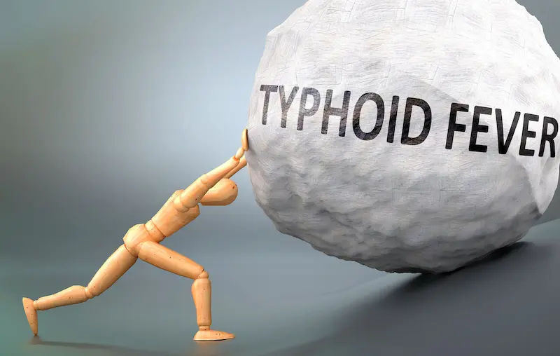 Understanding the Stages of Typhoid Fever